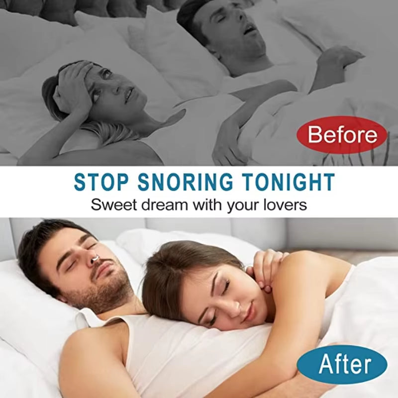 Anti Snoring Device Artifact Snoring Artifact Treatment Ventilation Nose Sticker Anti-Snoring Nose Clip Anti-Snoring Stickers